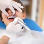 When Do Kids Need Their First Dental Checkup